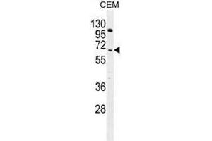 COL8A2 Antibody (C-term) western blot analysis in CEM cell line lysates (35µg/lane). (COL8a2 抗体  (C-Term, Chain alpha 2))