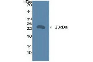 Detection of Recombinant TNFRSF5, Human using Polyclonal Antibody to Tumor Necrosis Factor Receptor Superfamily, Member 5 (CD40) (CD40 抗体  (AA 26-187))