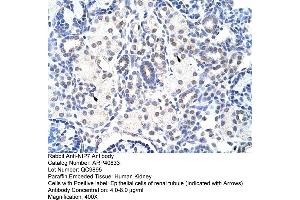Rabbit Anti-NIP7 Antibody  Paraffin Embedded Tissue: Human Kidney Cellular Data: Epithelial cells of renal tubule Antibody Concentration: 4. (NIP7 抗体  (C-Term))