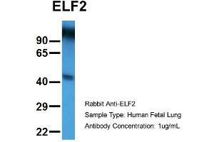 Host:  Rabbit  Target Name:  ELF2  Sample Type:  Human Fetal Lung  Antibody Dilution:  1. (ELF2 抗体  (N-Term))