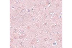 Immunohistochemistry (IHC) image for anti-Synaptogyrin 2 (SYNGR2) (N-Term) antibody (ABIN1031591) (SYNGR2 抗体  (N-Term))