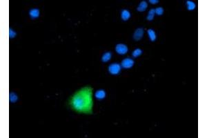 Anti-ANAPC2 mouse monoclonal antibody (ABIN2454940) immunofluorescent staining of COS7 cells transiently transfected by pCMV6-ENTRY ANAPC2 (RC207539). (ANAPC2 抗体)