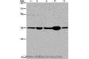 Western blot analysis of Human transitional cell carcinoma tissue, 293T and A172 cell, human testis tissue and Hela cell, using LZTFL1 Polyclonal Antibody at dilution of 1:550 (LZTFL1 抗体)
