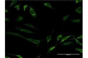 Immunofluorescence of monoclonal antibody to FH on HeLa cell. (FH 抗体  (AA 33-510))