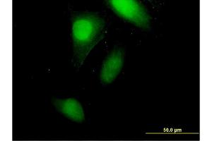Immunofluorescence of monoclonal antibody to CRABP2 on HeLa cell. (CRABP2 抗体  (AA 1-138))