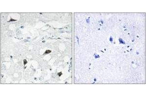 Immunohistochemistry analysis of paraffin-embedded human brain tissue, using Caspase 3 (Cleaved-Asp175) Antibody. (Caspase 3 抗体  (Cleaved-Asp175))