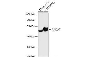 Western blot analysis of extracts of various cell lines using AADAT Polyclonal Antibody at dilution of 1:3000. (AADAT 抗体)