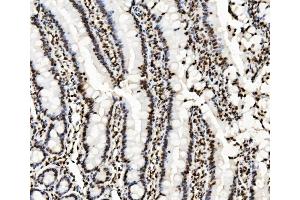 IHC analysis of KAP1/TRIM28 using anti-KAP1/TRIM28 antibody (ABIN7602310). (KAP1 抗体  (AA 699-835))