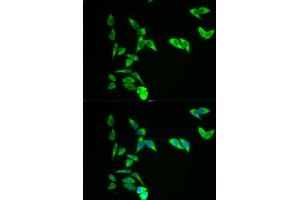 Immunofluorescence analysis of A549 cells using AK1 antibody. (Adenylate Kinase 1 抗体)