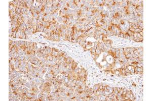 Immunohistochemistry (IHC) image for anti-Nicotinamide Nucleotide Transhydrogenase (NNT) (C-Term) antibody (ABIN2855538)