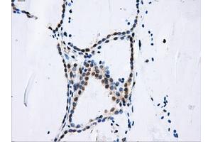 Immunohistochemical staining of paraffin-embedded liver tissue using anti-DCXRmouse monoclonal antibody. (DCXR 抗体)