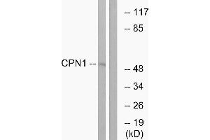 Western blot analysis of extracts from RAW264. (CPN1 抗体)