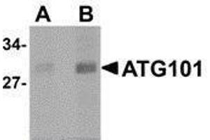 Western Blotting (WB) image for anti-Chromosome 12 Open Reading Frame 44 (C12orf44) (Center) antibody (ABIN2477522) (ATG101 抗体  (Center))
