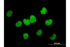 Immunofluorescence of monoclonal antibody to FKBP5 on HeLa cell. (FKBP5 抗体  (AA 1-457))