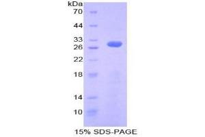 SDS-PAGE analysis of Human Ribonuclease Inhibitor Protein. (RNH1 蛋白)