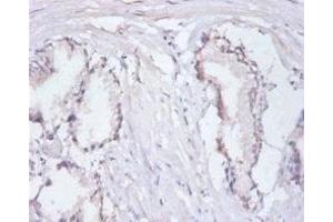 Immunohistochemistry of paraffin-embedded human prostate tissue using ABIN7167685 at dilution of 1:100 (RPA3 抗体  (AA 1-119))