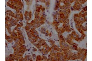 Immunohistochemistry (IHC) image for anti-CD8a Molecule (CD8A) antibody (ABIN7127409)