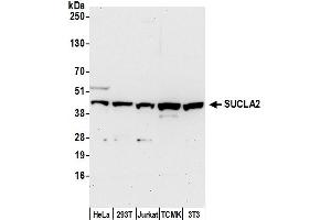 Western Blotting (WB) image for anti-Succinate-CoA Ligase, ADP-Forming, beta Subunit (SUCLA2) (AA 413-463) antibody (ABIN7451030)