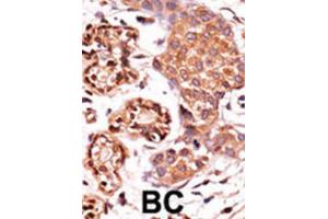 Immunohistochemistry (IHC) image for anti-C-Abl Oncogene 1, Non-Receptor tyrosine Kinase (ABL1) (pTyr412) antibody (ABIN3001744) (ABL1 抗体  (pTyr412))