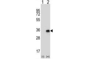 Western blot analysis of CNOT8 (arrow) using rabbit polyclonal CNOT8 Antibody (N-term) . (CNOT8 抗体  (N-Term))