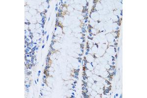 Immunohistochemistry of paraffin-embedded human colon using C antibody (ABIN7266074) at dilution of 1:100 (40x lens). (CA13 抗体  (AA 1-220))
