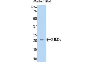 Detection of Recombinant NRP1, Human using Polyclonal Antibody to Neuropilin 1 (NRP1) (Neuropilin 1 抗体  (AA 646-814))