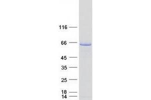 Western Blotting (WB) image for Glutamate Decarboxylase 1 (Brain, 67kDa) (GAD1) protein (Myc-DYKDDDDK Tag) (ABIN2721538)