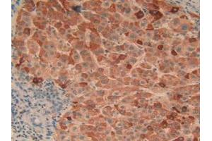 Immunohistochemistry (IHC) image for anti-Complement Component 1, Q Subcomponent, A Chain (C1QA) (AA 28-245) antibody (ABIN7435415)