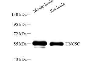 Western blot analysis of UNC5C (ABIN7076148),at dilution of 1: 800