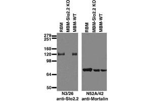 Immunoblot against brain membranes from adult rat (RBM), Slo2.