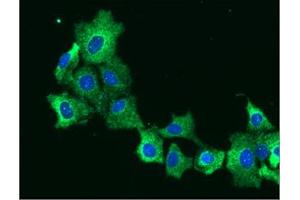 anti-Epoxide Hydrolase 1, Microsomal (Xenobiotic) (EPHX1) (AA 21-455) antibody