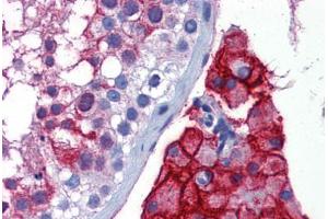 Immunohistochemistry (Formalin-fixed Paraffin-embedded Sections) (IHC (fp)) image for anti-Angiotensin I Converting Enzyme 2 (ACE2) (AA 684-733) antibody (ABIN768975)