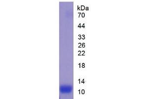 SDS-PAGE analysis of Mouse IL13Ra2 Protein. (IL13RA2 蛋白)