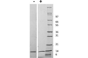 SDS-PAGE of Mouse Interleukin IL-31 Recombinant Protein SDS-PAGE of Mouse Interleukin-31 Recombinant Protein. (IL-31 蛋白)