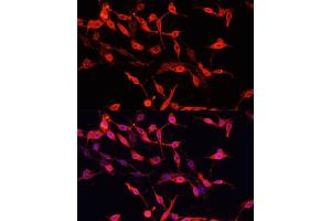 Immunofluorescence analysis of PC-12 cells using ENO3 antibody (ABIN7266960) at dilution of 1:100. (ENO3 抗体  (AA 1-190))