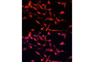 Immunofluorescence analysis of PC-12 cells using ENO3 antibody (ABIN7266960) at dilution of 1:100. (ENO3 抗体  (AA 1-190))
