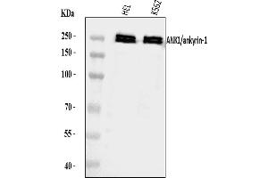 Western blot analysis of Ankyrin Erythroid/ANK/ANK1 using anti-Ankyrin Erythroid/ANK/ANK1 antibody (ABIN7599959).
