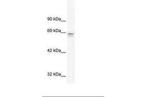 Image no. 1 for anti-Metal-Regulatory Transcription Factor 1 (MTF1) (AA 562-611) antibody (ABIN202901) (MTF1 抗体  (AA 562-611))