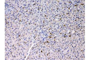 Immunohistochemistry (IHC) image for anti-phosphoserine Aminotransferase 1 (PSAT1) (AA 276-370) antibody (ABIN4886703)