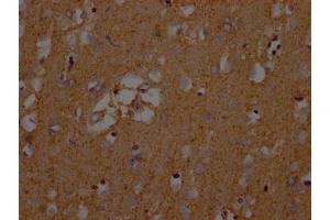 Immunohistochemistry (IHC) image for anti-Solute Carrier Family 1 (Glial High Affinity Glutamate Transporter), Member 3 (SLC1A3) (AA 146-236) antibody (ABIN7152226)