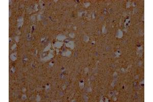 IHC image of ABIN7152226 diluted at 1:200 and staining in paraffin-embedded human brain tissue performed on a Leica BondTM system. (SLC1A3 抗体  (AA 146-236))