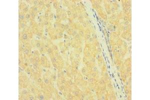 Immunohistochemistry of paraffin-embedded human liver tissue using ABIN7169972 at dilution of 1:100 (SLC38A9 抗体  (AA 1-119))