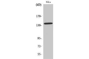 Western Blotting (WB) image for anti-Amyloid beta (Abeta) (pThr743) antibody (ABIN3173356) (beta Amyloid 抗体  (pThr743))