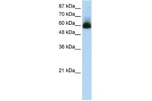 WB Suggested Anti-ZNF307 Antibody Titration:  1. (ZKSCAN4 抗体  (N-Term))