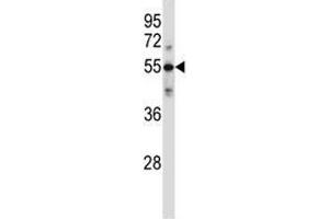 C9 antibody western blot analysis in ZR-75-1 lysate (C9 抗体  (AA 191-220))