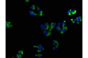 Immunofluorescence staining of HepG2 cells with ABIN7139899 at 1:50, counter-stained with DAPI. (OPRK1 抗体  (AA 31-50))