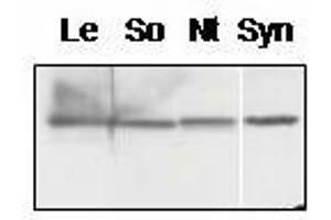 Western blot analysis of chloroplast proteins from tomato (Lycopersicum esculentum, Le, spinach (Spinacia oleracea, So), tobacco (Nicotiana tabacum, Nt) and membrane proteins from Synechocystis sp. (PsbQ 抗体)