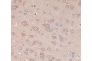 Figure. (Cathepsin D 抗体  (AA 54-121))