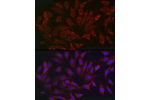 Immunofluorescence (IF) image for anti-NLR Family, Pyrin Domain Containing 1 (NLRP1) (AA 1000-1100) antibody (ABIN7268935)