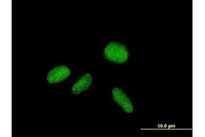 Immunofluorescence of purified MaxPab antibody to ZNF584 on HepG2 cell. (ZNF584 抗体  (AA 1-421))